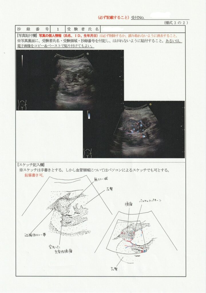 超音波検査士泌尿器症例レポート