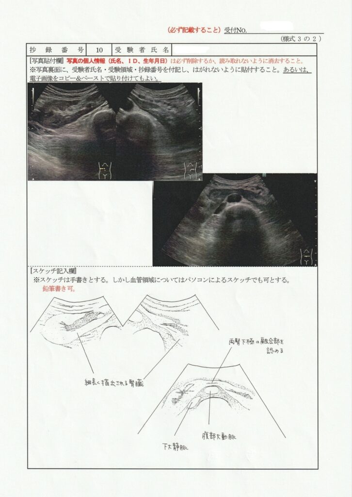 超音波検査士泌尿器症例レポート