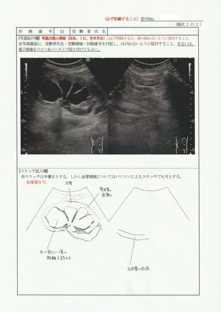 超音波検査士泌尿器症例レポート