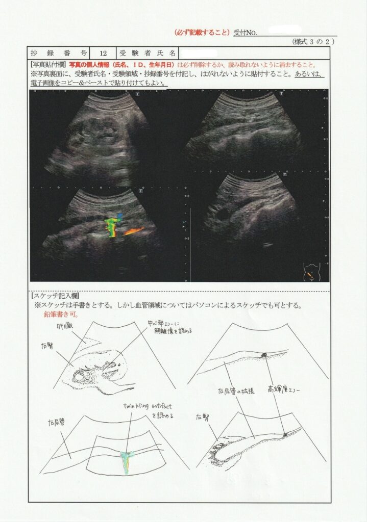 超音波検査士泌尿器症例レポート