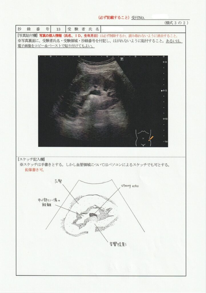 超音波検査士泌尿器症例レポート