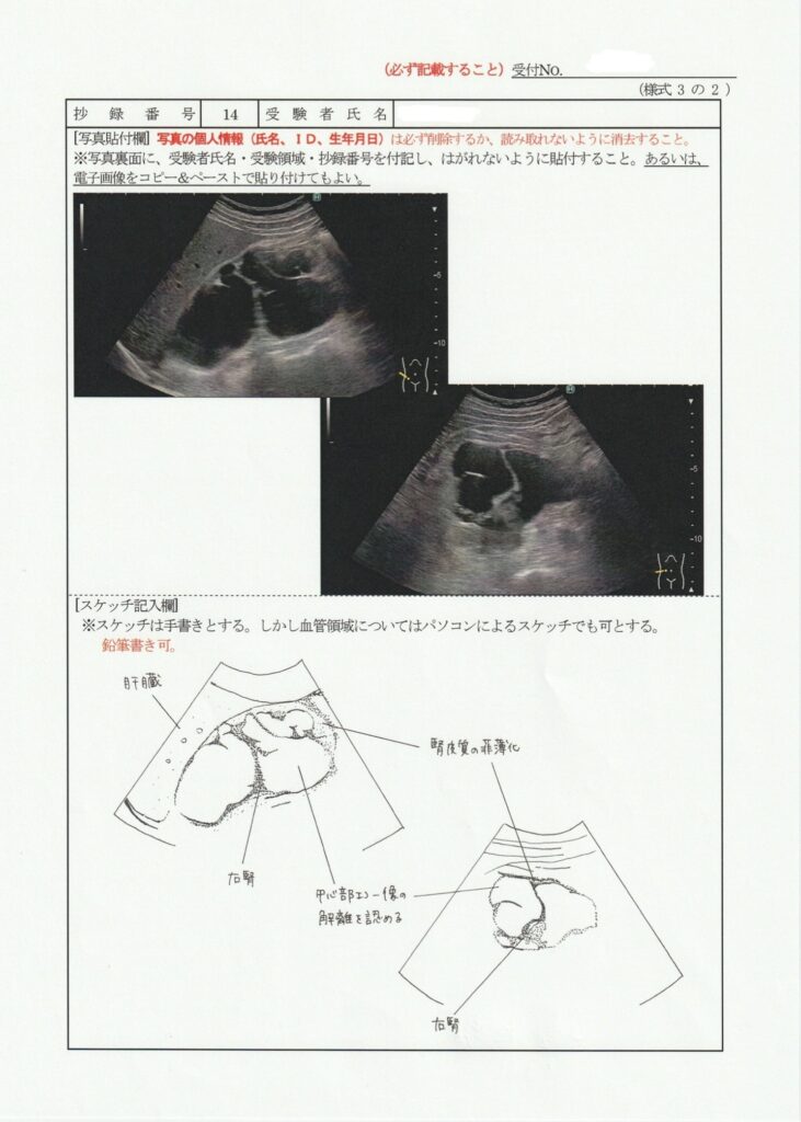 超音波検査士泌尿器症例レポート