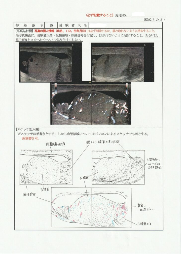 超音波検査士泌尿器症例レポート