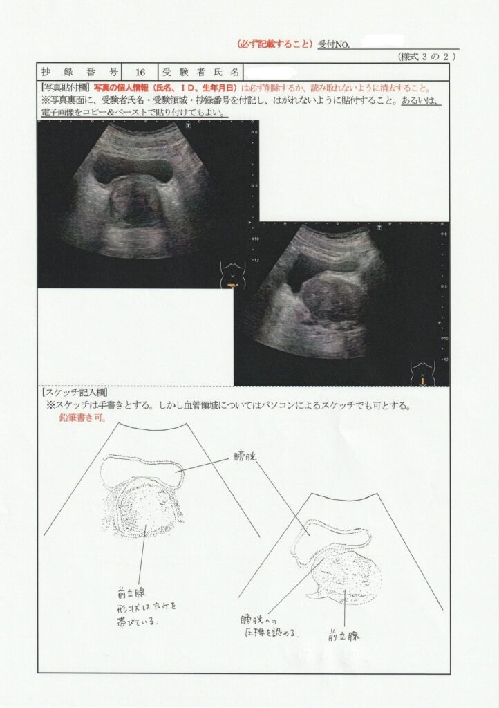 超音波検査士泌尿器症例レポート