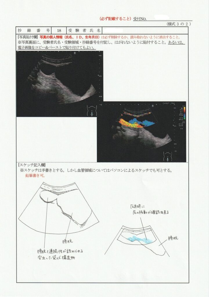 超音波検査士泌尿器症例レポート