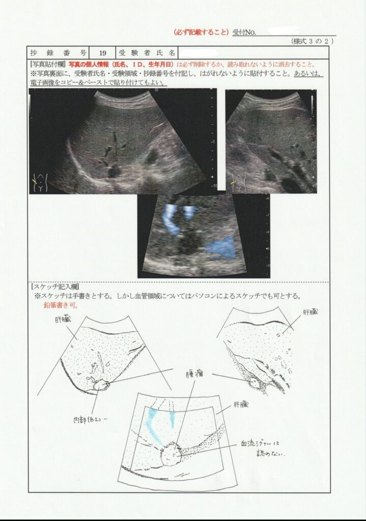 超音波検査士泌尿器症例レポート