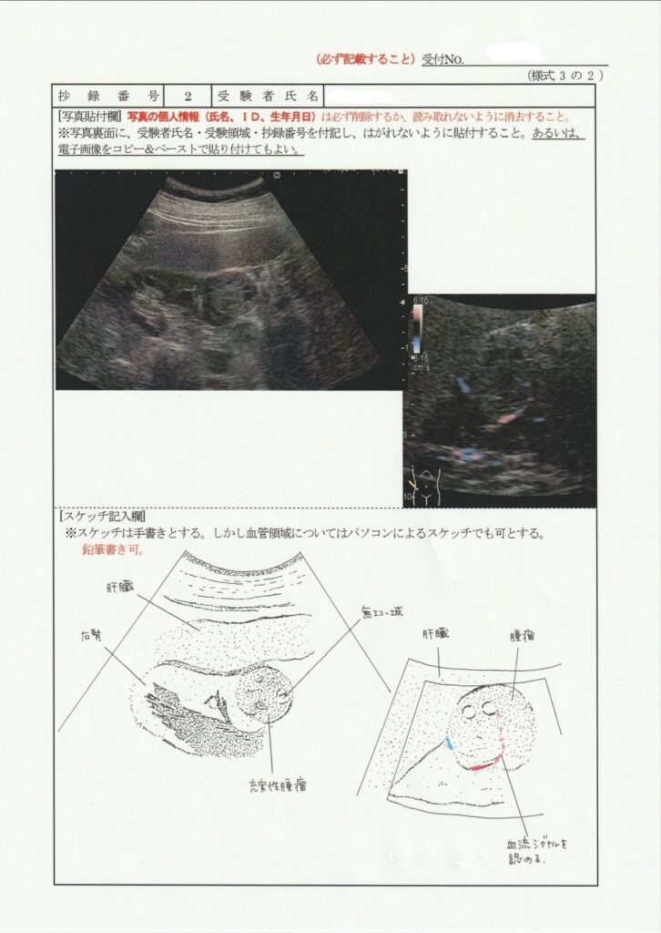 超音波検査士泌尿器症例レポート