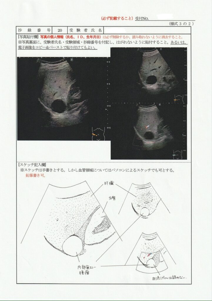 超音波検査士泌尿器症例レポート