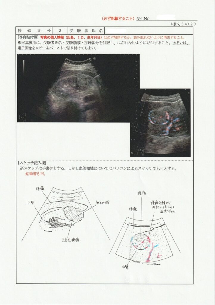 超音波検査士泌尿器症例レポート