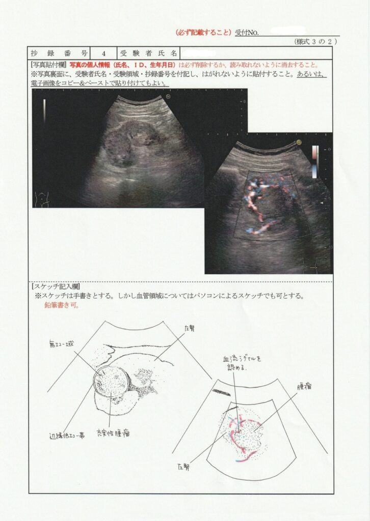 超音波検査士泌尿器症例レポート