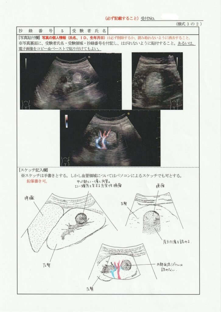 超音波検査士泌尿器症例レポート