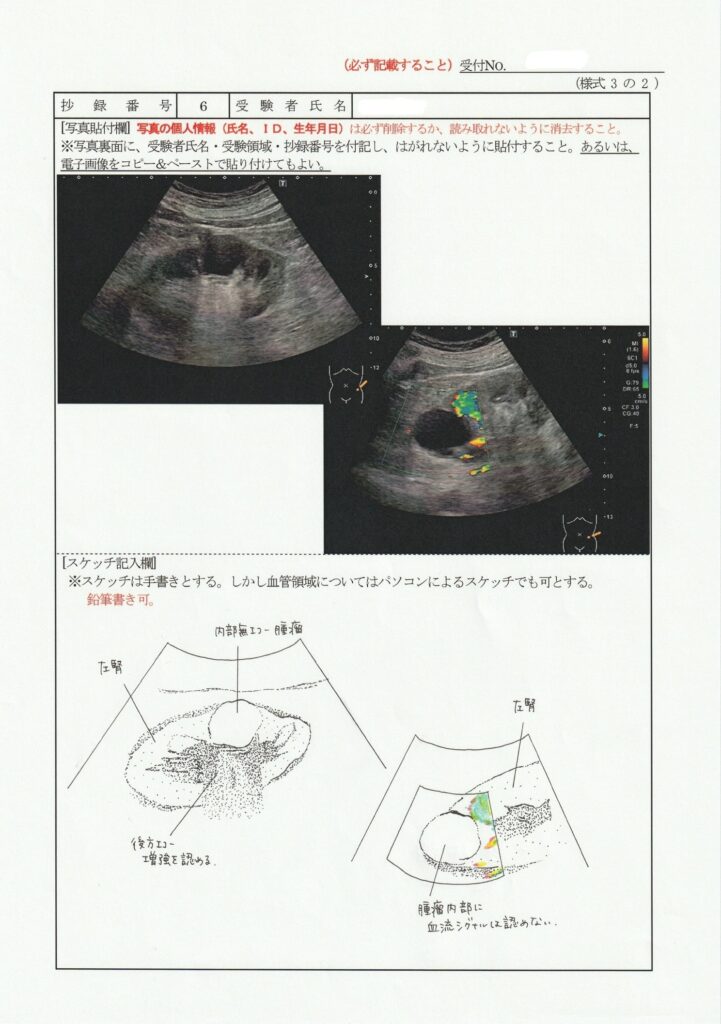 超音波検査士泌尿器症例レポート