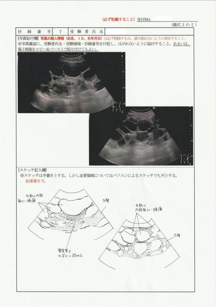 超音波検査士泌尿器症例レポート