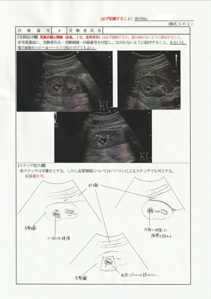 超音波検査士泌尿器症例レポート