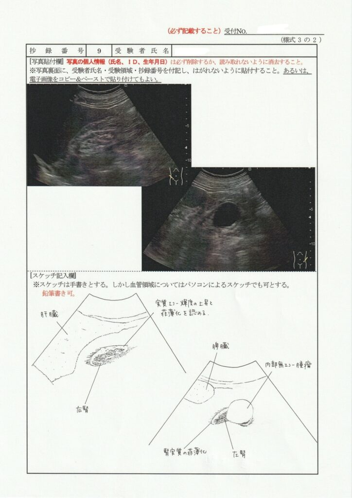 超音波検査士泌尿器症例レポート