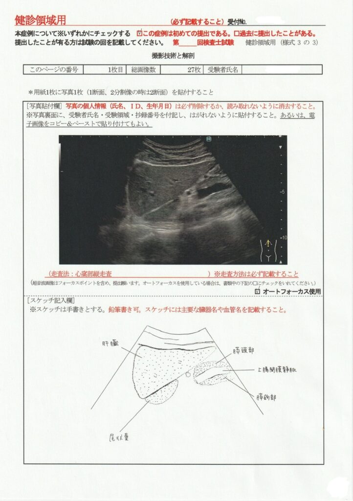 超音波検査士けんしん撮影技術と解剖１