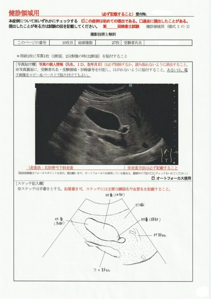 超音波検査士けんしん撮影技術と解剖１０