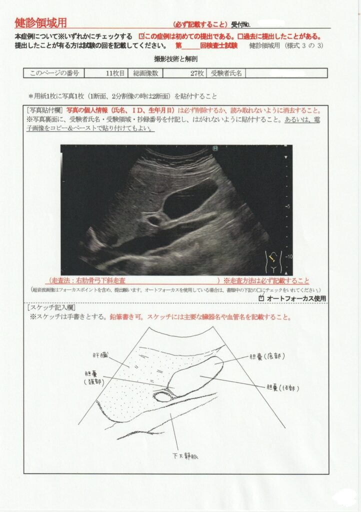 超音波検査士けんしん撮影技術と解剖１１