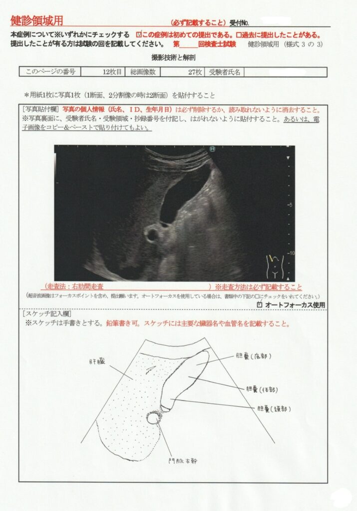 超音波検査士けんしん撮影技術と解剖１２