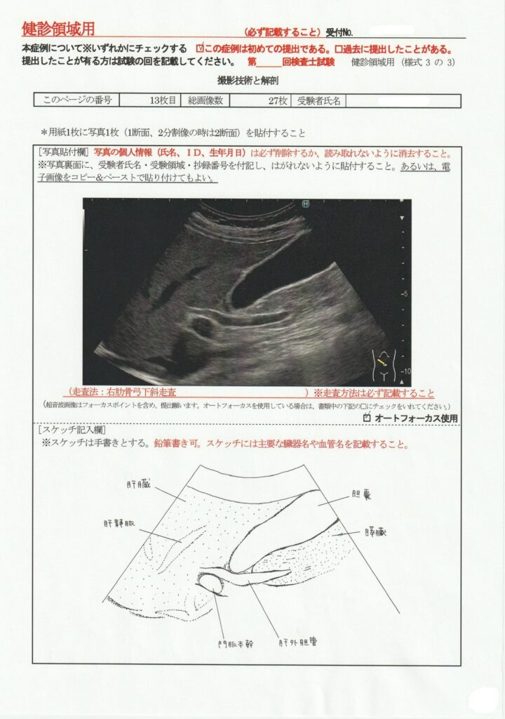 超音波検査士けんしん撮影技術と解剖１３