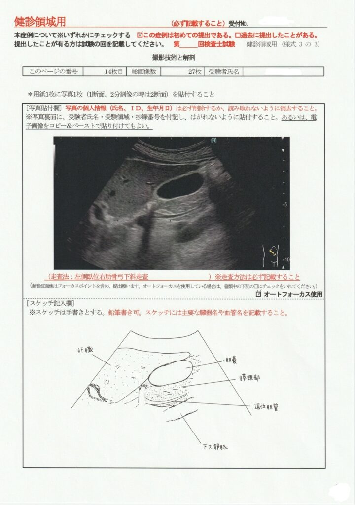 超音波検査士けんしん撮影技術と解剖１４