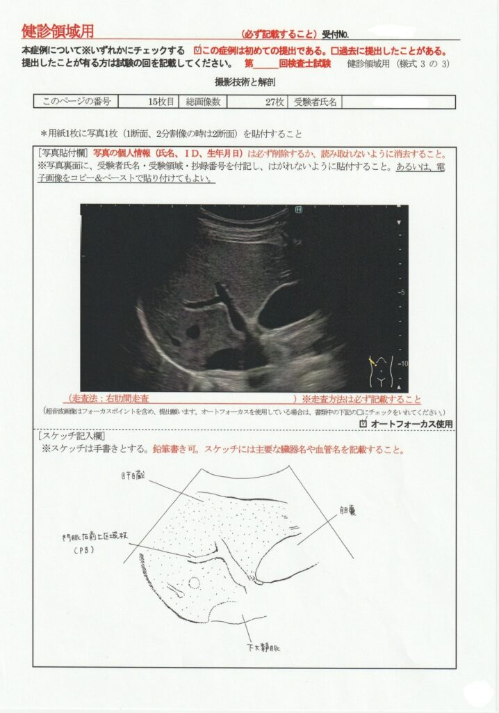 超音波検査士けんしん撮影技術と解剖１５