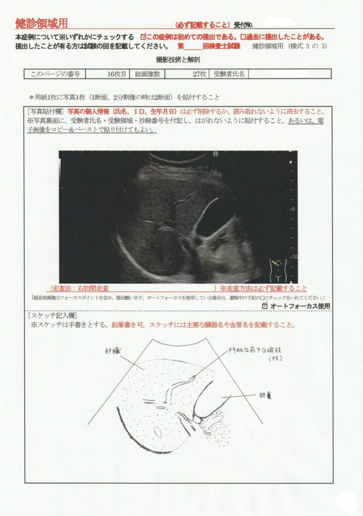 超音波検査士けんしん撮影技術と解剖１６