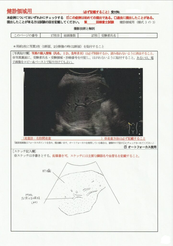 超音波検査士けんしん撮影技術と解剖１７