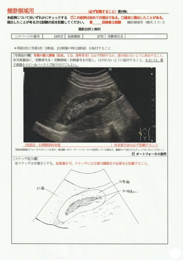 超音波検査士けんしん撮影技術と解剖１８