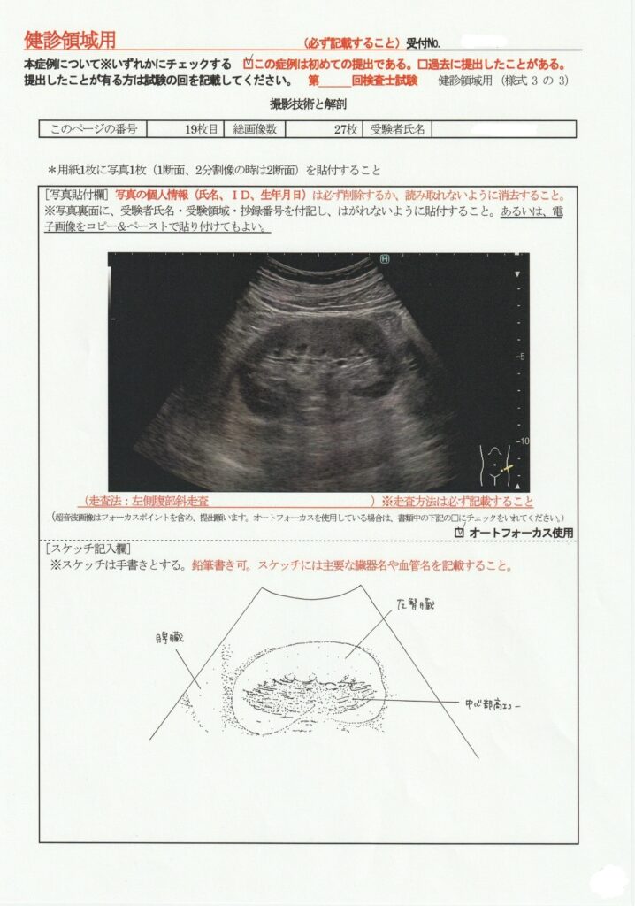 超音波検査士けんしん撮影技術と解剖１９