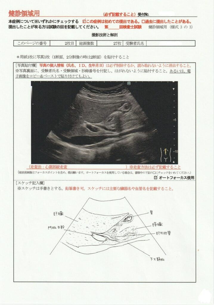 超音波検査士けんしん撮影技術と解剖２