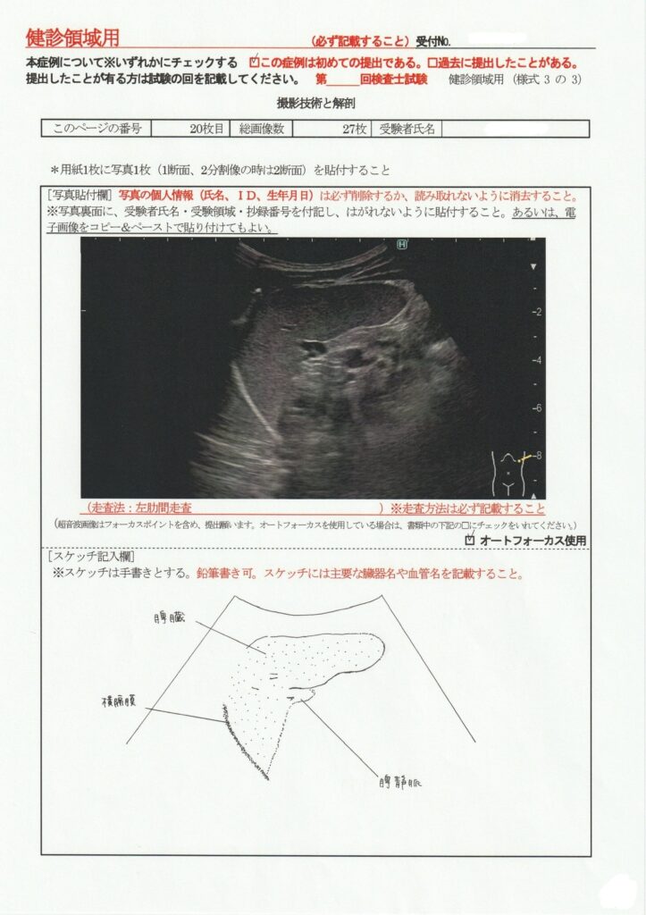 超音波検査士けんしん撮影技術と解剖２０