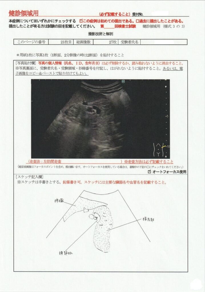 超音波検査士けんしん撮影技術と解剖２１