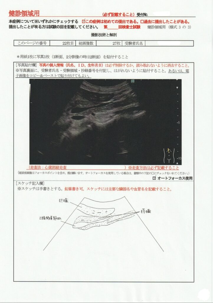 超音波検査士けんしん撮影技術と解剖２２