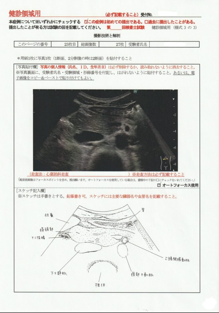 超音波検査士けんしん撮影技術と解剖２４