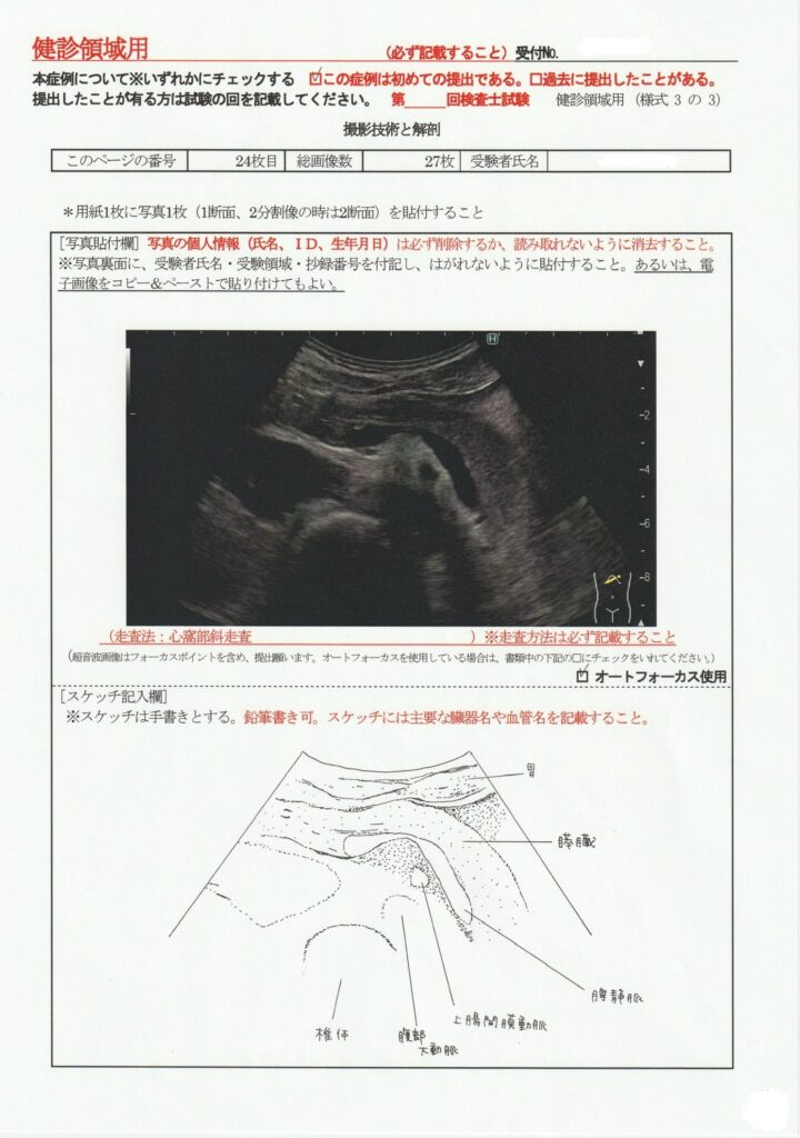 超音波検査士けんしん撮影技術と解剖２４