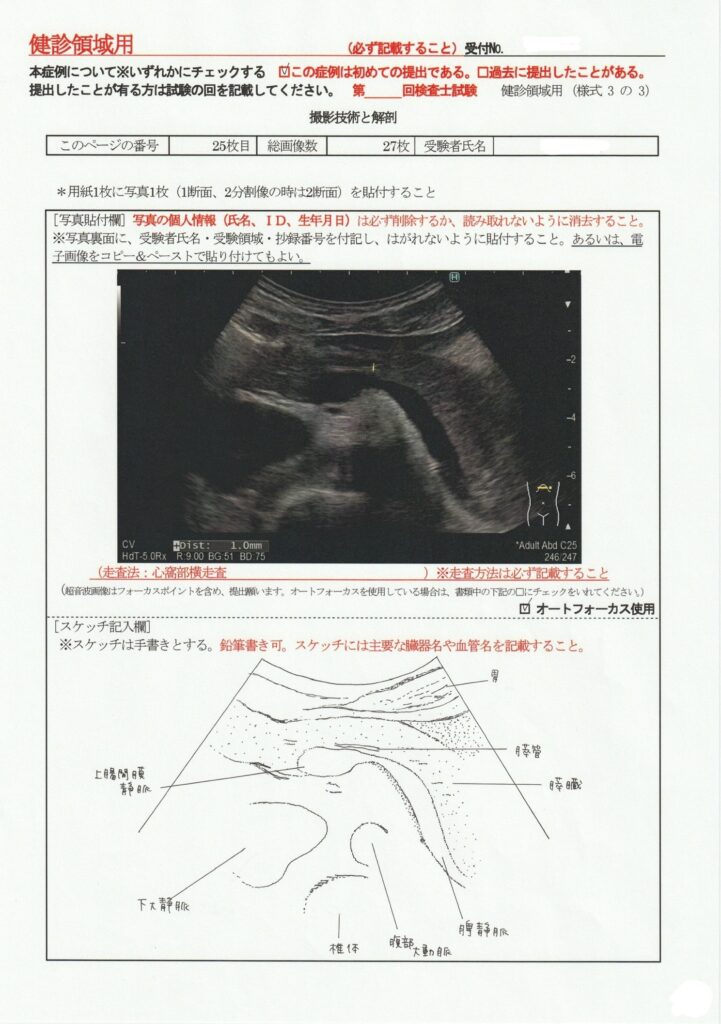 超音波検査士けんしん撮影技術と解剖２５