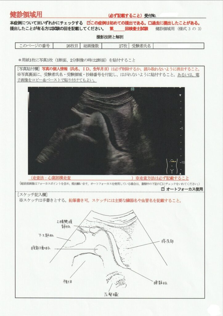 超音波検査士けんしん撮影技術と解剖２６