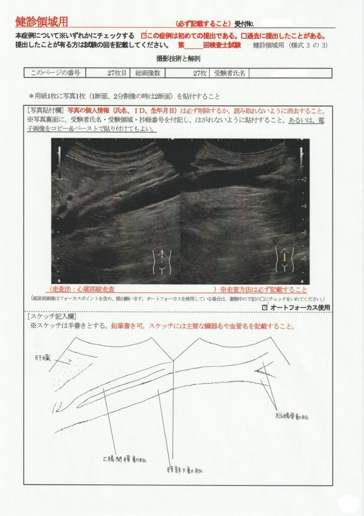 超音波検査士けんしん撮影技術と解剖２７