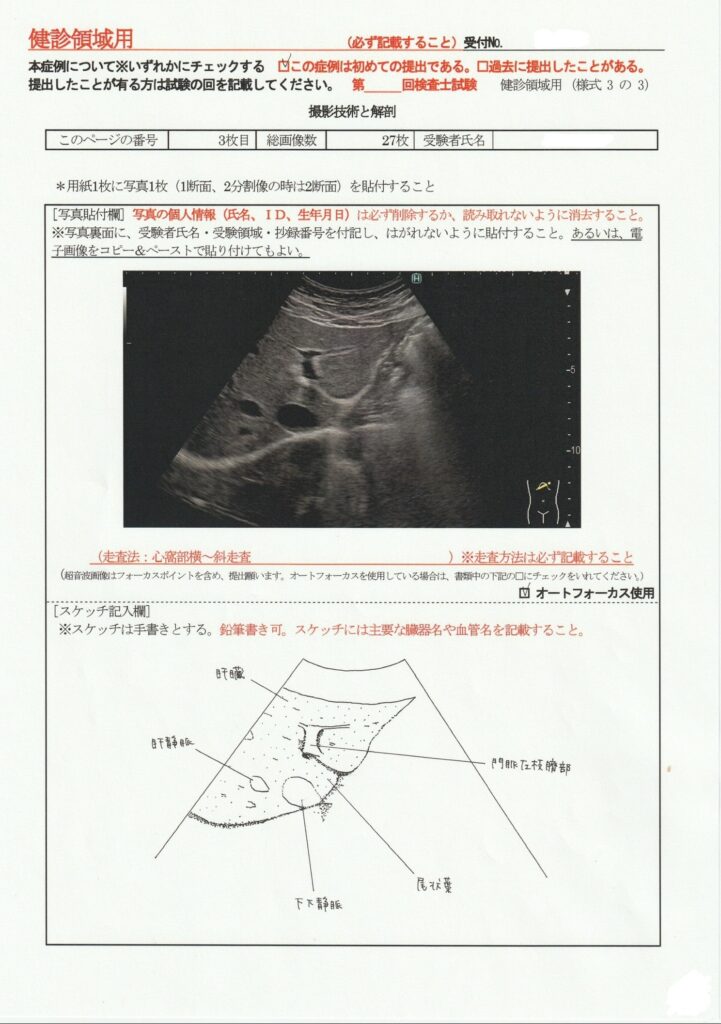 超音波検査士けんしん撮影技術と解剖３