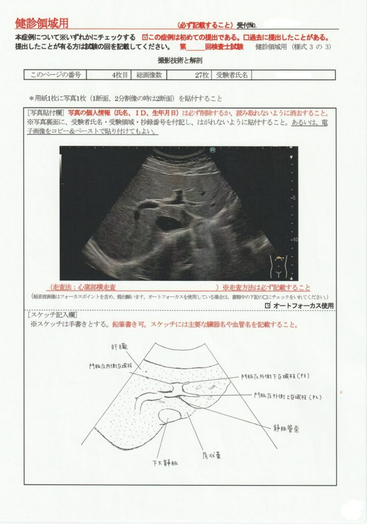 超音波検査士けんしん撮影技術と解剖４