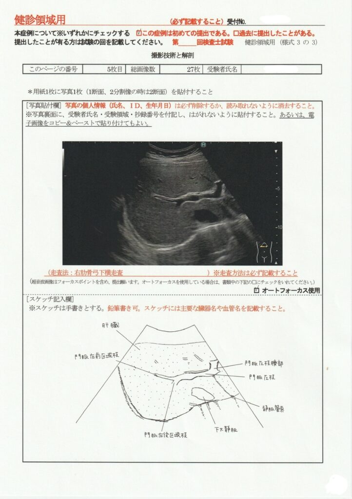 超音波検査士けんしん撮影技術と解剖５