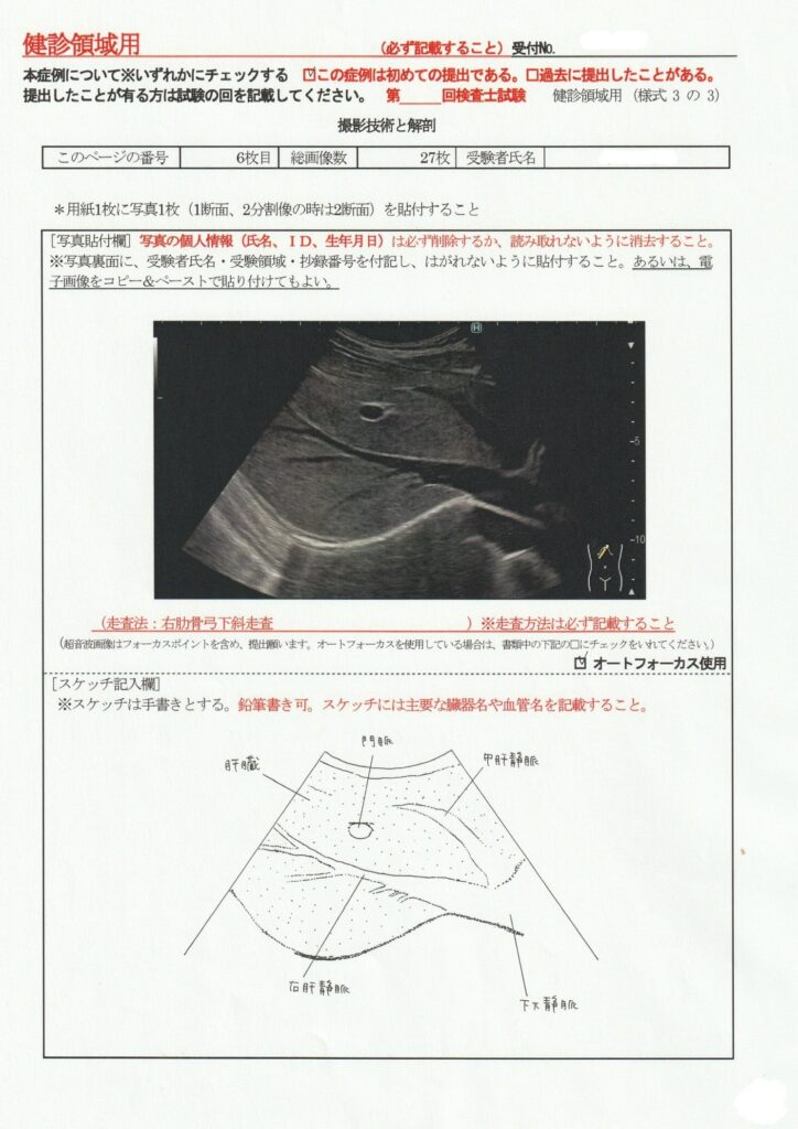 超音波検査士けんしん撮影技術と解剖６