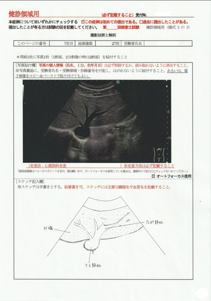 超音波検査士けんしん撮影技術と解剖７