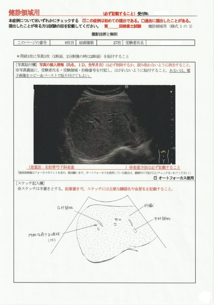 超音波検査士けんしん撮影技術と解剖８