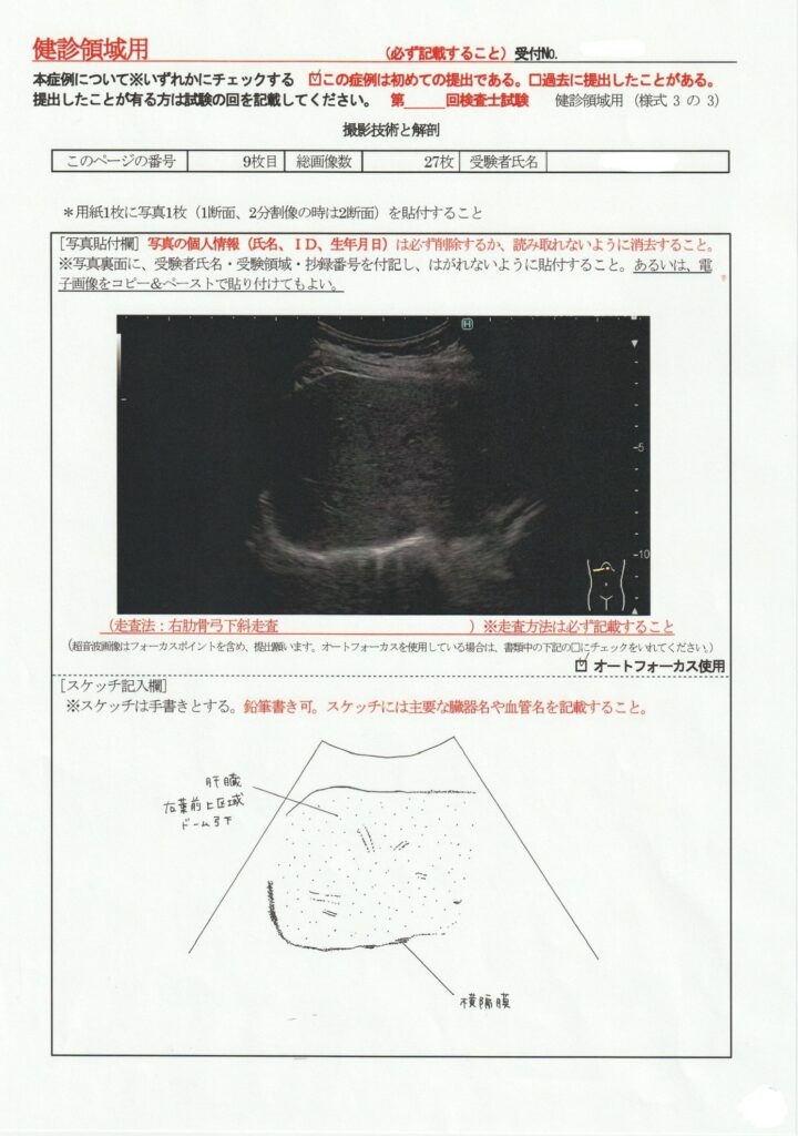 超音波検査士けんしん撮影技術と解剖９