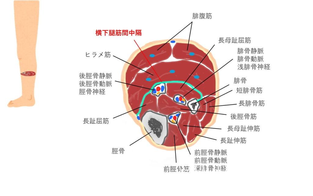 横下腿筋間中隔